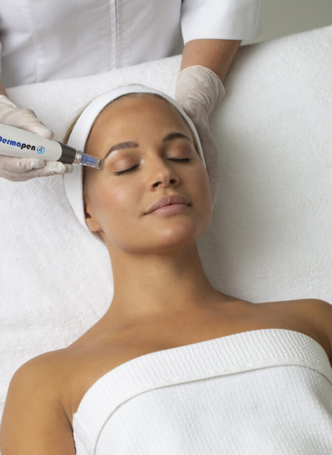 Dermapen glow
